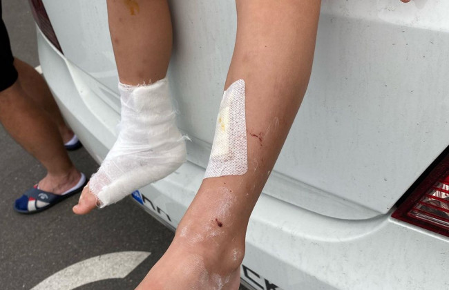 В киевском ТРЦ на ребенка упала витрина: у мальчика все тело в порезах и сломана нога