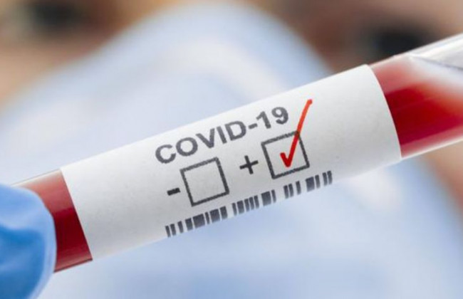 Появился новый штамм коронавируса: где его обнаружили