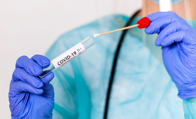 Ситуация с COVID-19: в Украине 618 новых случаев заражения