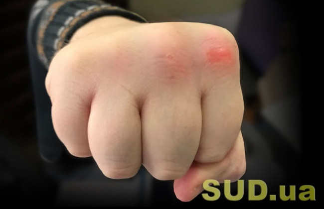 Ватажка незаконного збройного формування в «ДНР» судитимуть за катування та вбивство двох людей