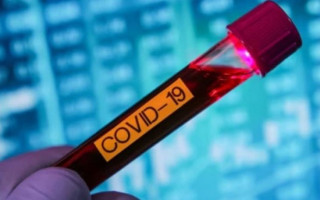 Обнаружили еще одну опасность коронавируса