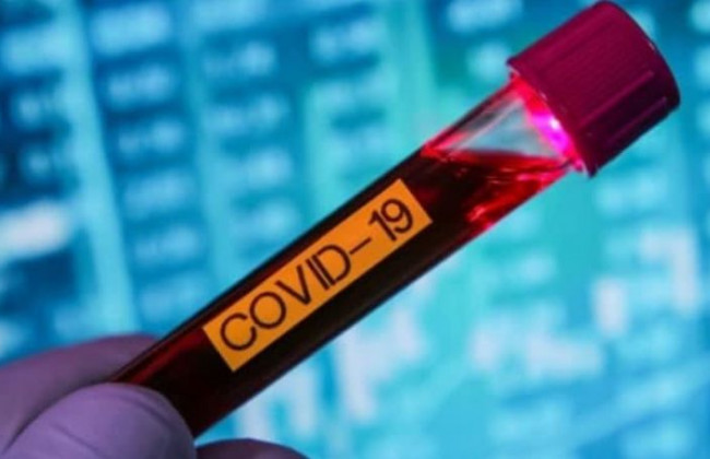 Обнаружили еще одну опасность коронавируса