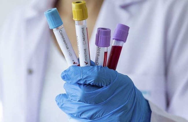 Медики сообщили, для кого наиболее опасен штамм Дельта