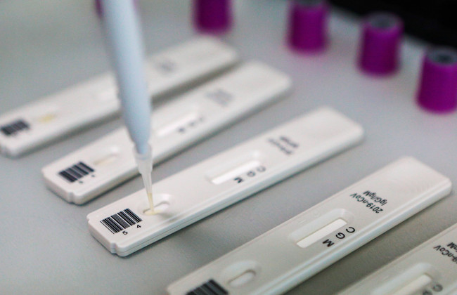 Тесты на антитела от коронавируса не очень точны, – врач-инфекционист