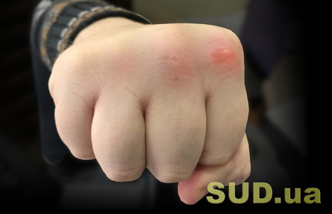 В центре Киева произошла массовая драка