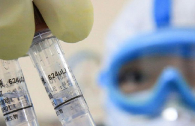 Может вызвать отказ органов: назвали причину опасного осложнения COVID-19