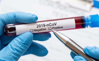 В Сумской области зафиксировали заражение штаммом «Дельта»