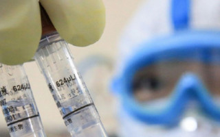 Может вызвать отказ органов: назвали причину опасного осложнения COVID-19