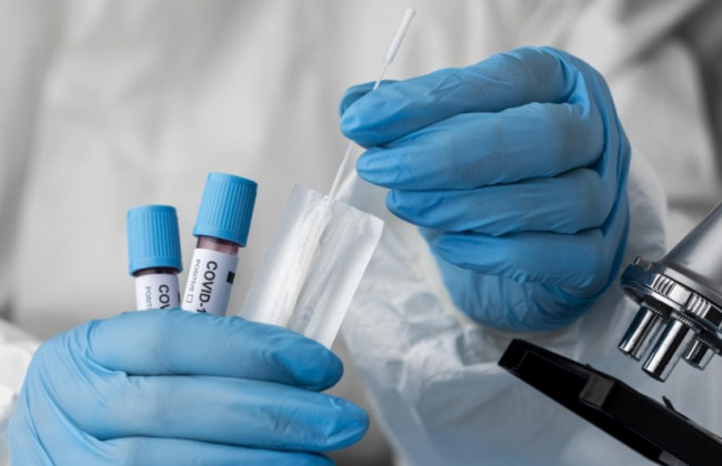 В Полтавской области подтверждено 30 случаев заболеваемости штаммом «Дельта»