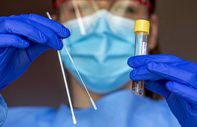 В Украине 417 новых случаях коронавируса