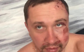 У Житомирі невідомі напали на журналіста місцевої газети