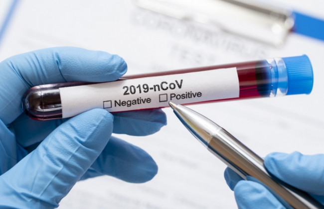 Рост случаев: в Украине более 1700 новых зараженных COVID-19