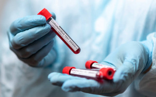 В Украине 727 новых заболевших коронавирусом