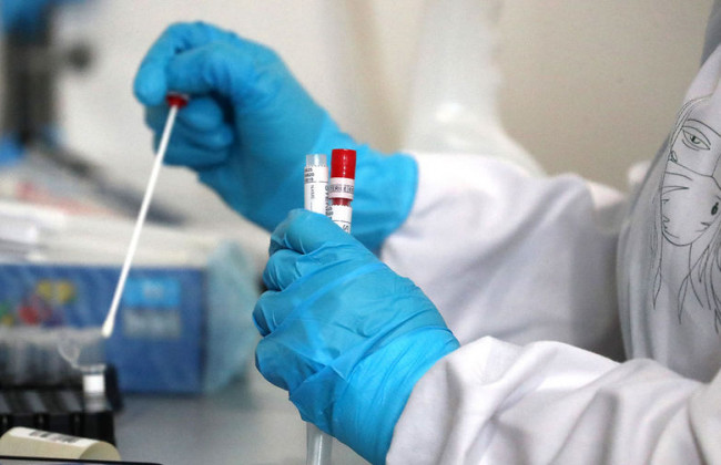 В Україні виявили понад 2 тисячі нових випадків коронавірусу: статистика