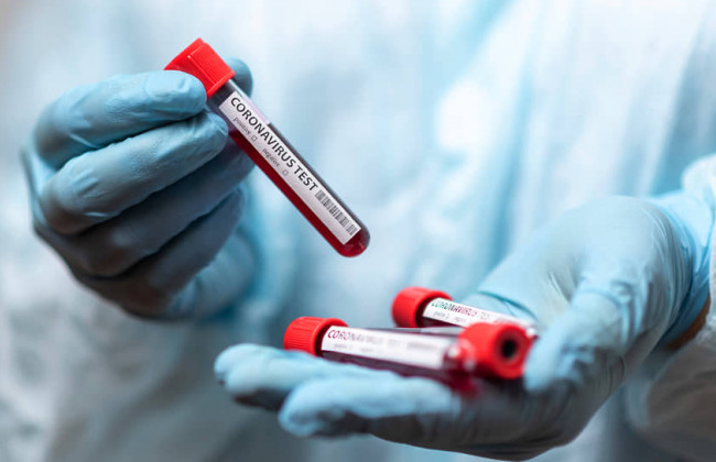 Коронавирус в Украине: за прошедшие сутки заболели 749 человек