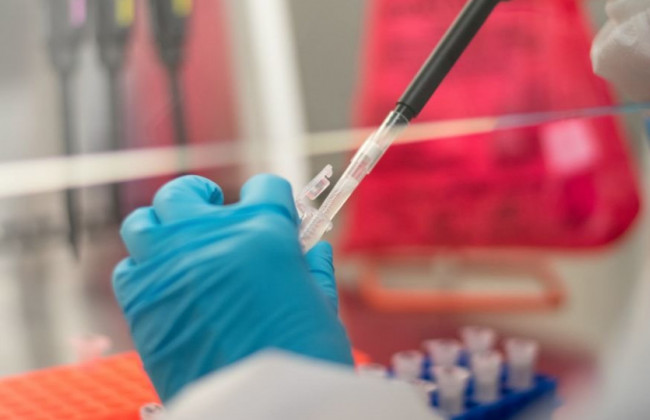 Врачи раскрыли, как именно коронавирус убивает людей