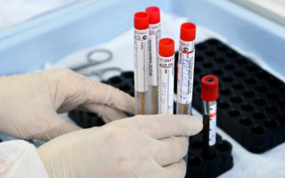 Стремительный рост: в Украине более 3600 новых случаев COVID-19