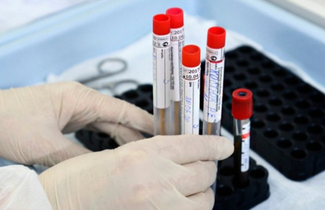 Стремительный рост: в Украине более 3600 новых случаев COVID-19