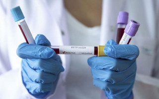 Анализ пота вместо ПЦР: разработали новый метод выявления COVID-19