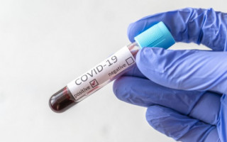 Ситуация с COVID-19 в Украине: за сутки 3 869 новых больных