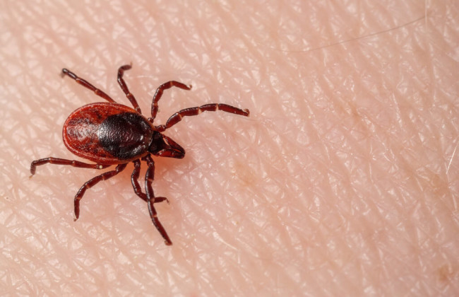 В Одесской области школьника парализовало после укуса клеща