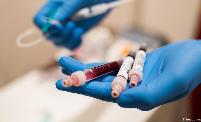 Врач рассказал, у кого может не возникнуть антител к коронавирусу