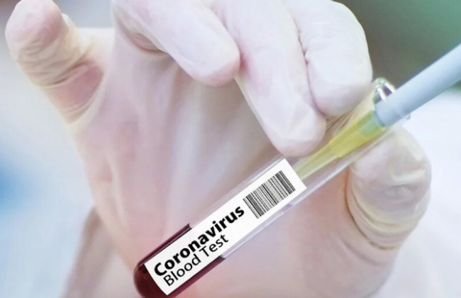 У больных COVID-19 изменились основные симптомы