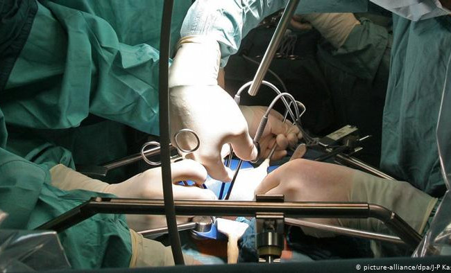 Питання трансплантації анатомічних матеріалів людині: Рада прийняла законопроект за основу