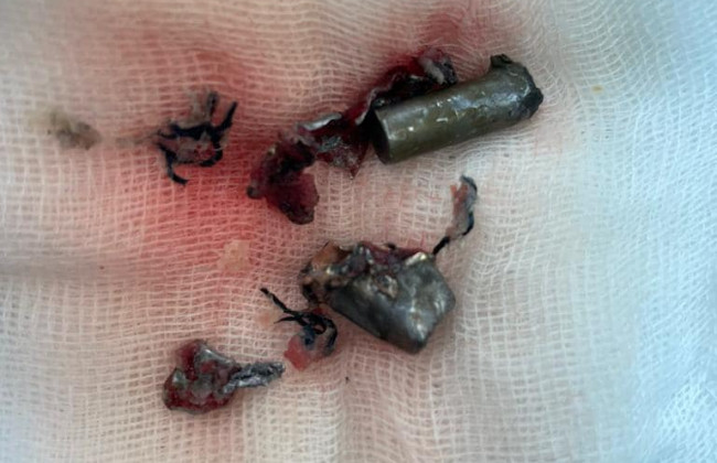 Путь реформ и изменений в стране не остановить, – Монастырский о нападении на Шефира