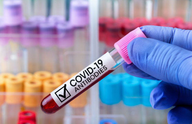 Какой процент населения Украины имеет антитела к коронавирусу