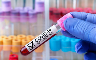 Какой процент населения Украины имеет антитела к коронавирусу