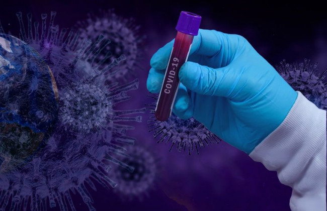 Ученые назвали самый «миролюбивый» штамм коронавируса