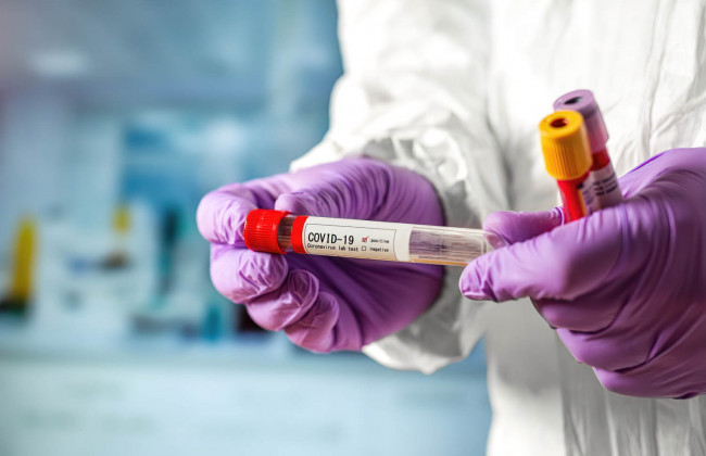 Коронавирус в Украине: за сутки около 3 тысяч новых случаев