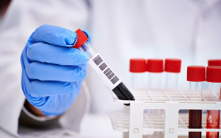 Врач рассказал, почему тесты не всегда выявляют штамм «Дельта»