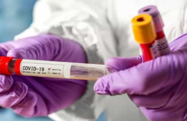 «Дельта плюс»: опасен ли новый штамм коронавируса