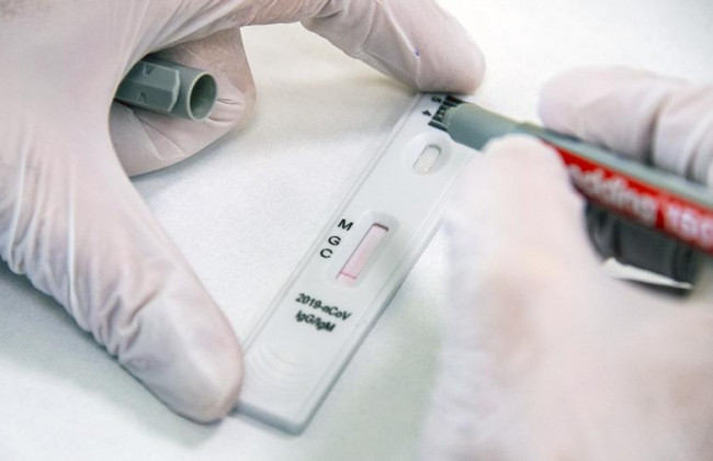 Стоит ли делать тест на антитела после вакцинации: Минздрав дал ответ