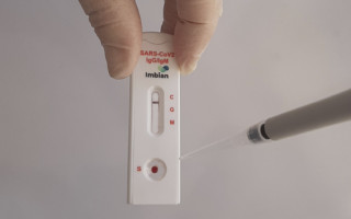 Врачи рассказали, у кого не вырабатываются антитела к коронавирусу