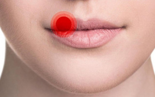 Какое осложнение грозит переболевшим коронавирусом