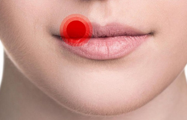 Какое осложнение грозит переболевшим коронавирусом