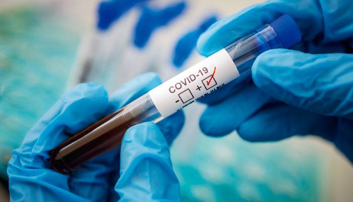 В Украине  зафиксировали более 11 тысяч COVID-случаев