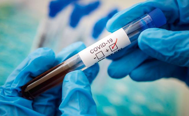 В Украине  зафиксировали более 11 тысяч COVID-случаев