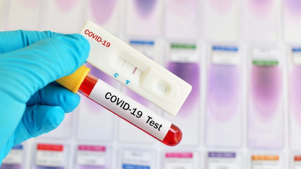 Германия и Швейцария отменили бесплатные экспресс-тесты на коронавирус