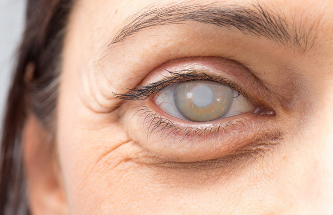 Офтальмолог рассказала о тяжелых последствиях коронавируса для зрения