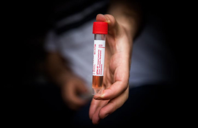 Ученые нашли способ точно предсказать тяжесть течения COVID-19