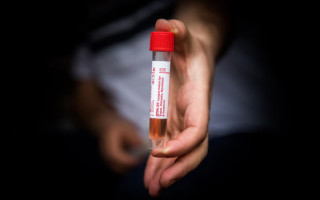 Ученые нашли способ точно предсказать тяжесть течения COVID-19