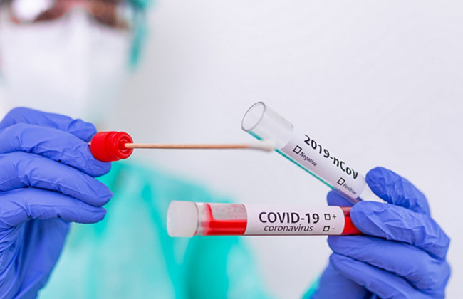 В Украине 22 415 новых случаев коронавируса: рекорд по смертям