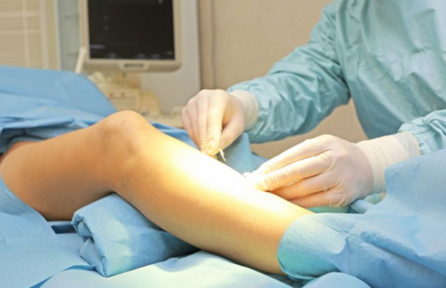 Ампутация конечностей и тромбозы: назвали тяжелые осложнения штамма «Дельта»