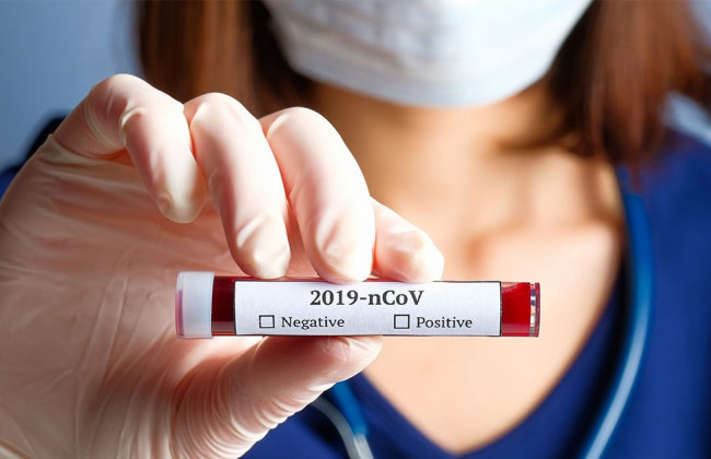 В Украине подтвердили почти 21 тысячу новых случаев COVID-19