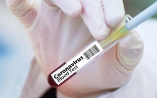 Откуда появился COVID-19: в США представили новую версию происхождения вируса
