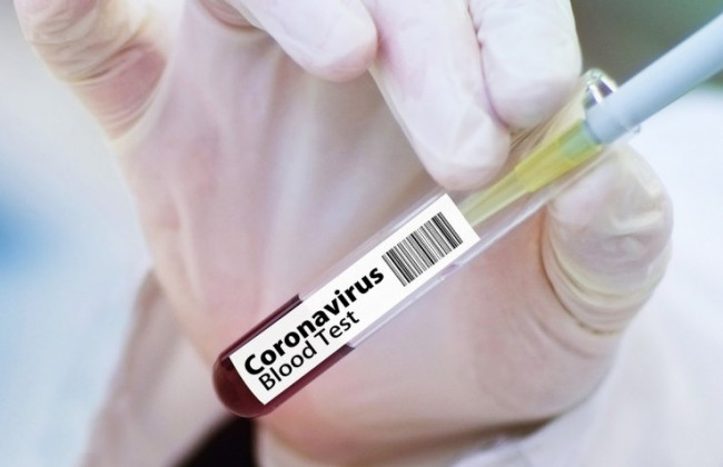 Откуда появился COVID-19: в США представили новую версию происхождения вируса